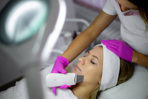 Chemical peels in Abu Dhabi