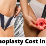 Vaginoplasty Surgery in Delhi