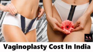 Vaginoplasty Surgery in Delhi