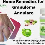 Herbal Supplements for Granuloma Annulare