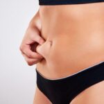 Tummy Tuck Dubai 13