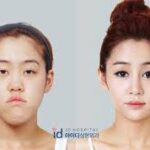 safe plastic surgery