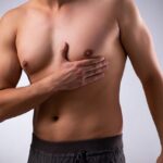 Does Gynecomastia Surgery Leave Visible Scars