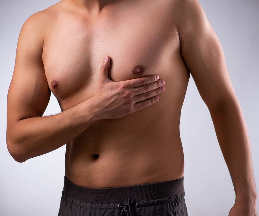 Does Gynecomastia Surgery Leave Visible Scars
