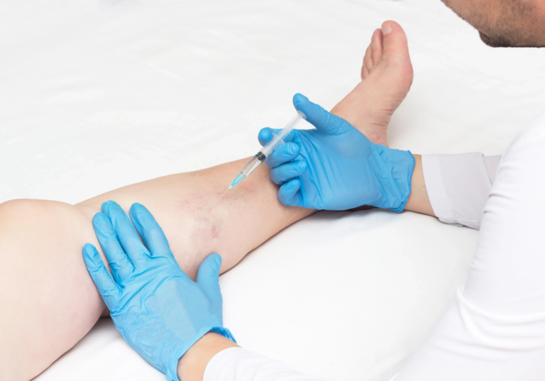 Does Varicose Veins Treatment Prevent Future Veins