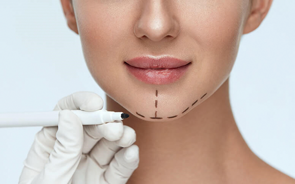 How Jawline Treatment Shapes a More Defined Profile