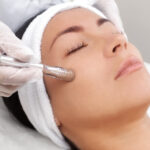 How Laser Acne Scar Treatment Boosts Skin Renewal