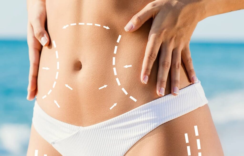 How Long Does Body Contouring Treatment Results Last