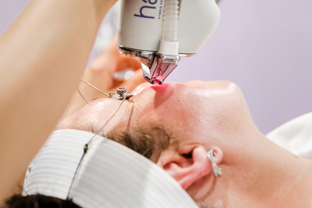 How Often Should You Get Halo Treatment Done