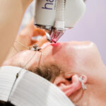 How Often Should You Get Halo Treatment Done