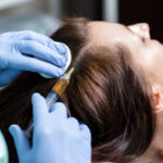How Often Should You Get PRP Hair Treatment Sessions