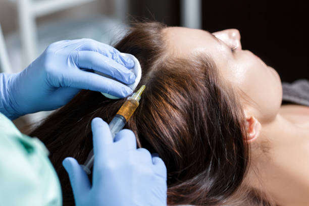 How Often Should You Get PRP Hair Treatment Sessions