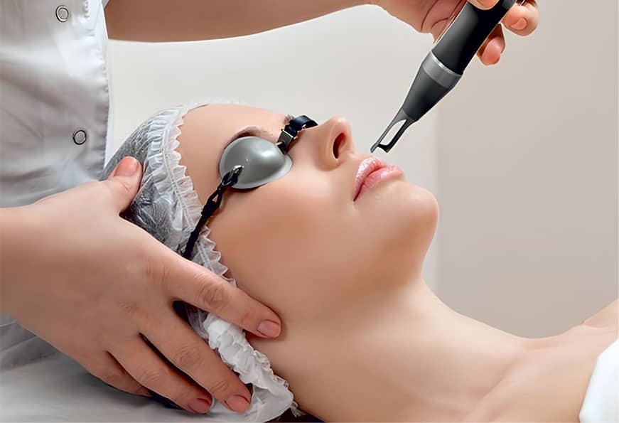 How Pico Laser Treatment Rejuvenates Your Skin