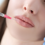 Is Russian lip Fillers Safe for First Time Users