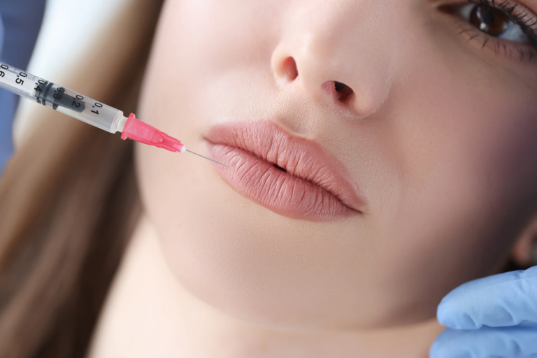 Is Russian lip Fillers Safe for First Time Users