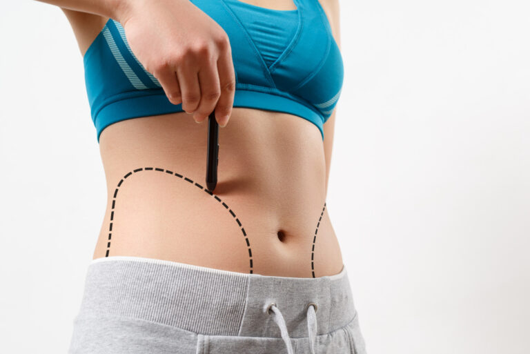 vaser liposuction in dubai