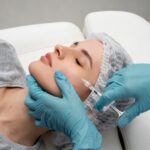 Sculptra treatment