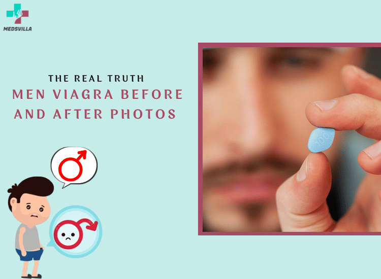 The-Real-Truth-Men-Viagra-Before-and-After-Photos (1)