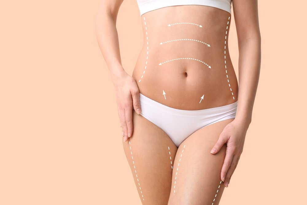 What Makes Waist Sculpting So Popular Today