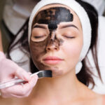 What Results Can You Expect From a Laser Carbon Peel?