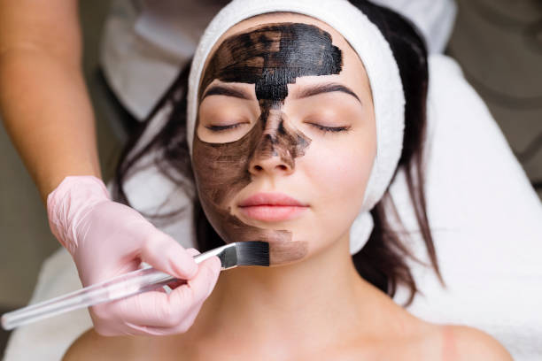 What Results Can You Expect From a Laser Carbon Peel?