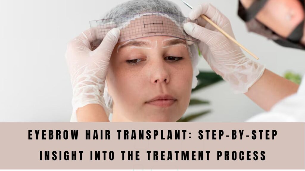 Eyebrow Hair Transplant: Step-by-Step Insight Into the Treatment Process