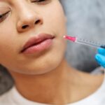 lip filler