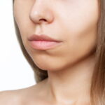 Does Buccal Fat Removal Change Your Facial Shape