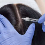 Does Hair Fillers Treatment Really Boost Hair Growth