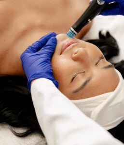 Does HydraFacial Reduce Acne And Blackheads