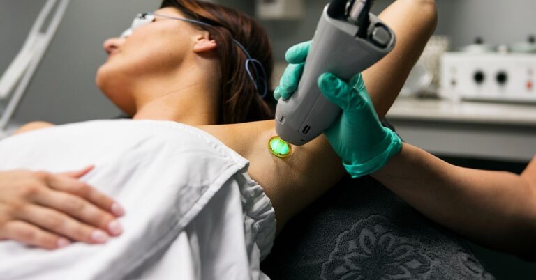 Does Laser Hair Removal Hurt During Treatment