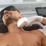 Does Men’s Laser Hair Removal Work on All Hair Types