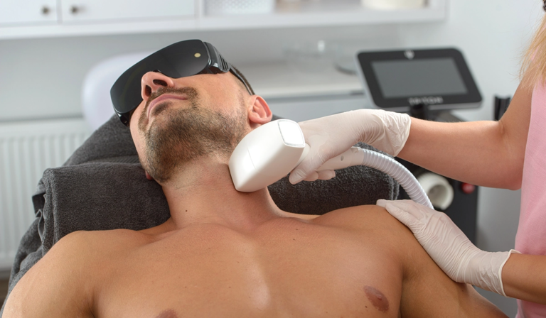 Does Men’s Laser Hair Removal Work on All Hair Types