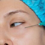 Does PDRN Treatment Really Reduce Wrinkles Fast