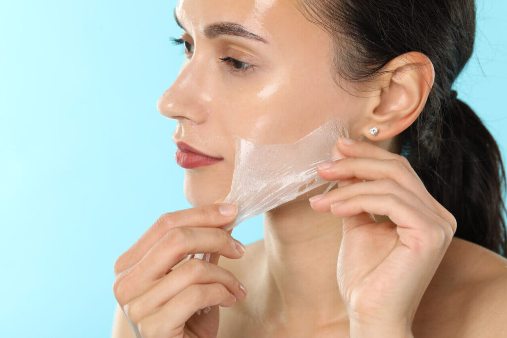 Does a Chemical Peel Reduce Acne Scars Fast