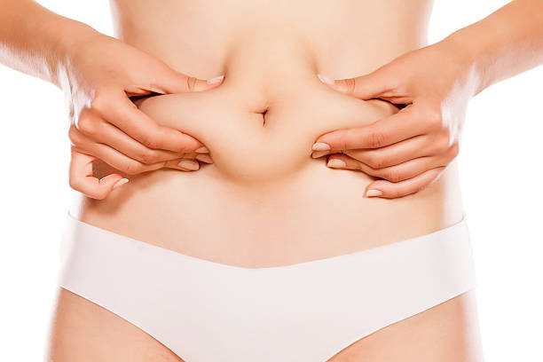 What to Know Before Getting Coolsculpting Done