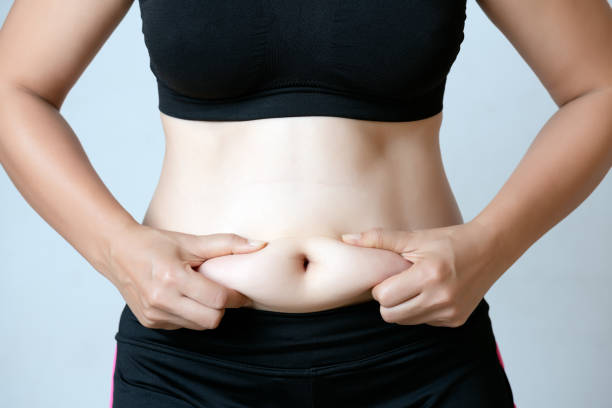How Does Tummy Tuck Enhance Self-Confidence