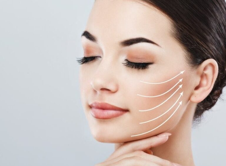 How Effective Is Thread Lift for Facial Lifting