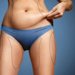How Is Body Jet Liposuction Different From VASER