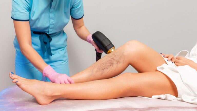 How Long Does Sclerotherapy Take to Show Results