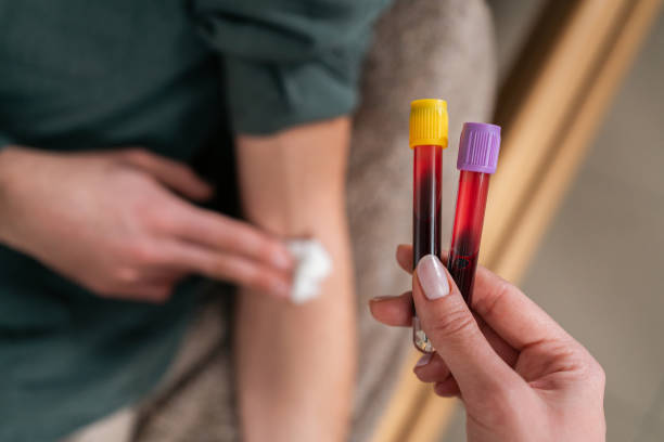 How Often Should You Get a Complete Blood Test