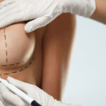 Is Breast Lift Surgery Right for Every Age Group