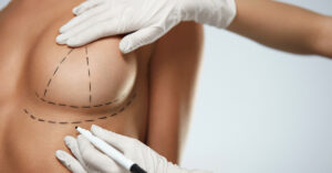 Is Breast Lift Surgery Right for Every Age Group