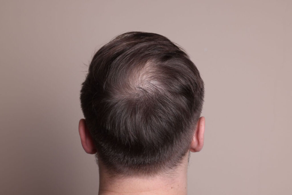 Is GFC Treatment for Hair Painful or Safe
