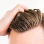 Is Hair Transplant Better Than Other Hair Loss Options