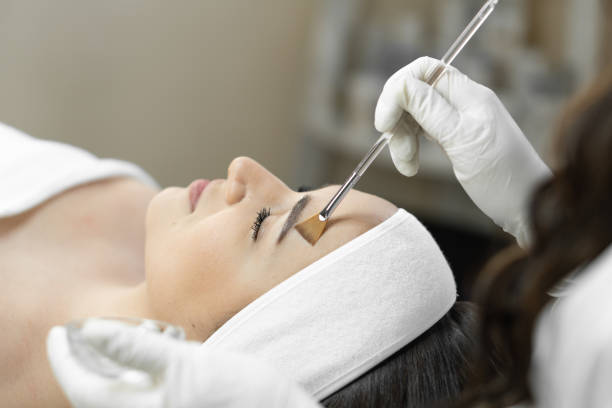 Is a Chemical Peel Safe for Sensitive Skin