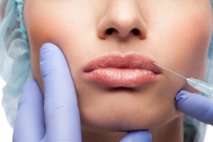 What Are the Cosmetic Benefits of Lip Fillers