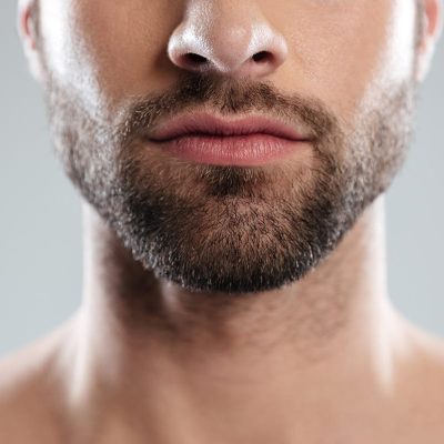 beard-hair-transplant-dubai-2-rfpdx86axc24gax5ql0xocovwkkfa3lntq1vmvrt7k