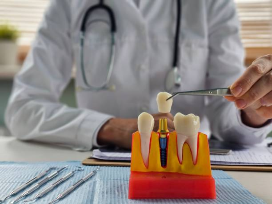 3D printed dental implant guide