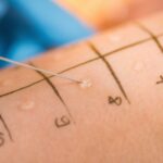 Allergy-Testing-in-Dubai-Allergy-Department-2